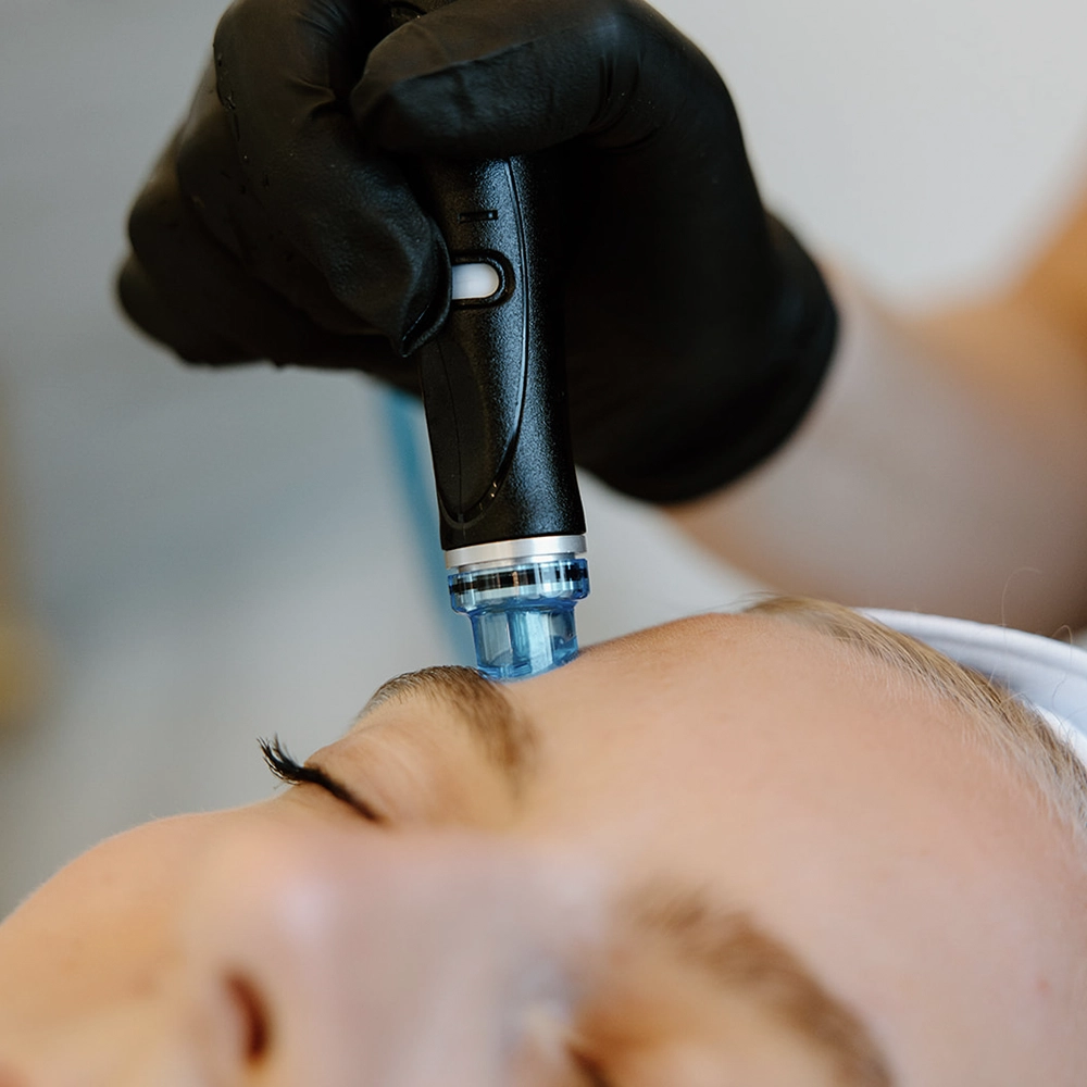Kunde får Hydrabeauty Facial